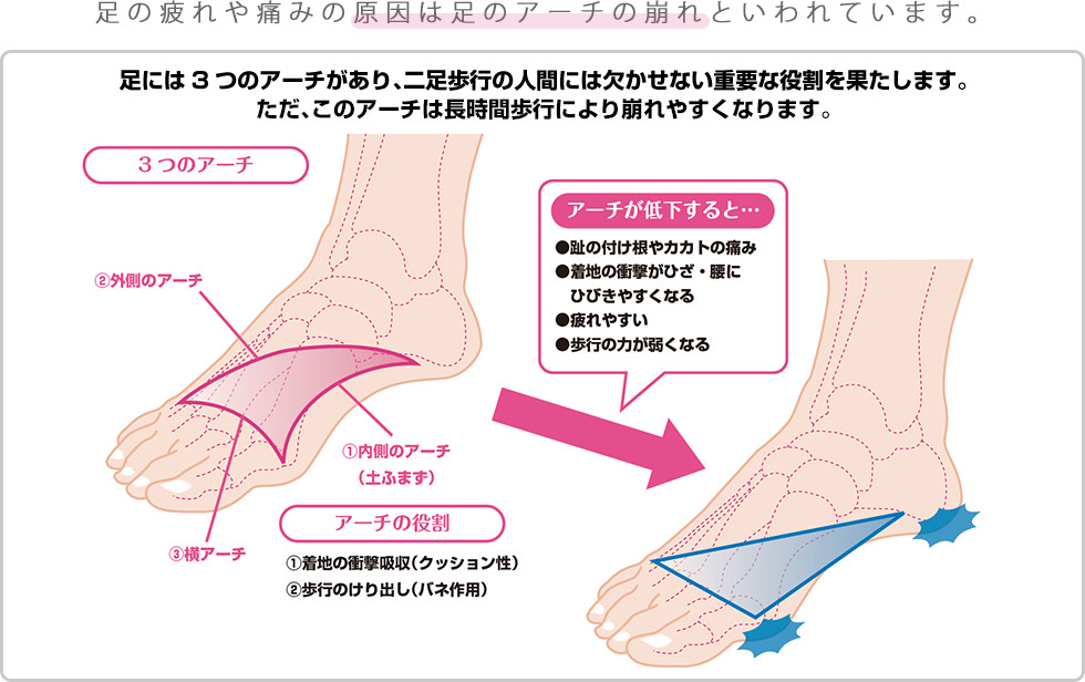 足の疲れや痛みの原因は足のアーチの崩れといわれています。