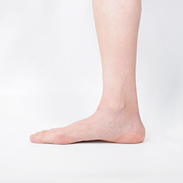 チラチーノの足　側面